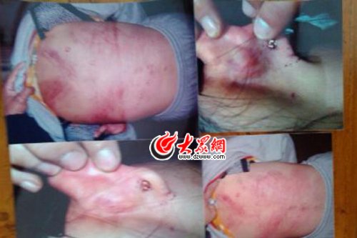 　山東藝術(shù)設(shè)計學(xué)院16歲女生宿舍內(nèi)被女同學(xué)暴打4小時。
