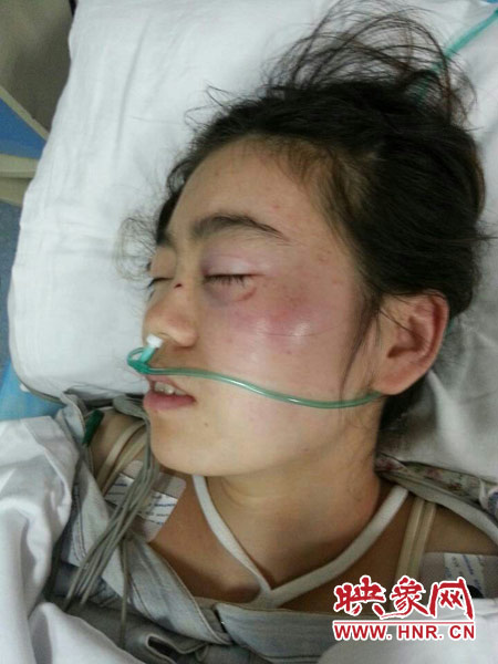 9月10日晚,被暴打的小陳出現(xiàn)了間歇性昏迷,被送進(jìn)了省人民醫(yī)院。
