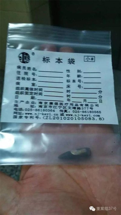 經(jīng)警方鑒定，秦女士體內(nèi)取出的子彈系56式步槍射出 。 受訪者供圖