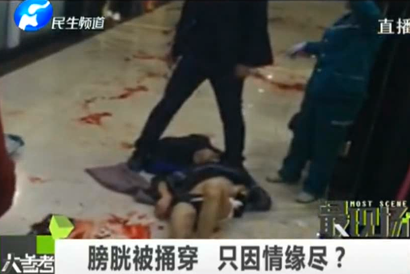 膀胱被捅穿 只因情緣盡？